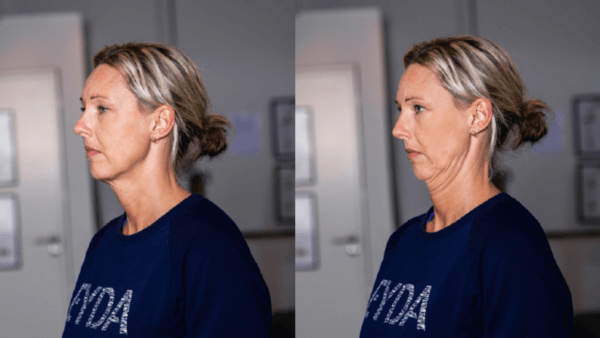 Øvelser for nakken