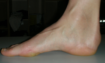Figur 3